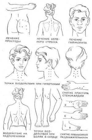 obezbolivaniye_1