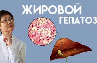 vino i zhirovoy gepatoz