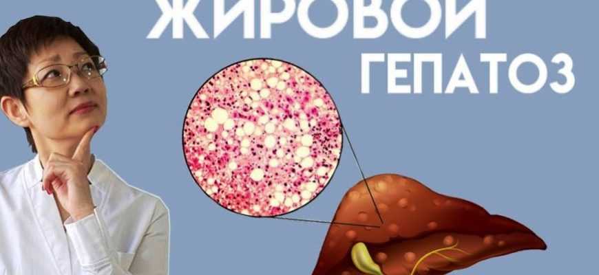 vino i zhirovoy gepatoz