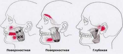 Жевательная мышца