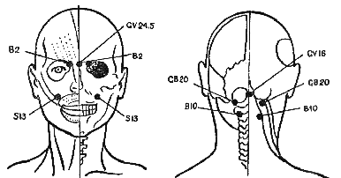tochechnyj-massazh4