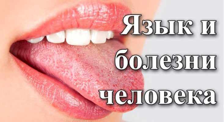 yazyk-diagnostika-zdorovya-organizma