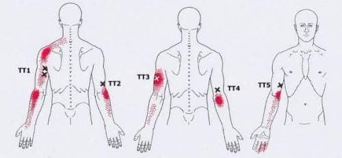 aacdcffadaedecef