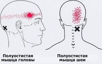 fadaefdde