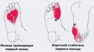 ecdcdfddebd